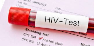 Battle with AIDS – Where Do You Fall?