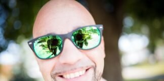 Alopecia Areata – Know About Baldness baldness in men