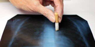Cases of TB fall