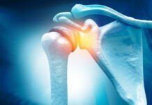 Rotator Cuff Injury