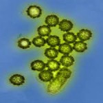 H1N1-virus-health-niche