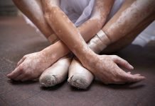 Is it Possible to Get Rid of Vitiligo – Myths & FAQs Answered get rid of vitiligo