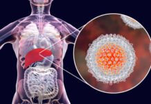 All You Need To Know About Hepatitis C: Symptoms, Causes, Treatments, Diagnosis And Home Remedies All you need to know about Hepatitis c